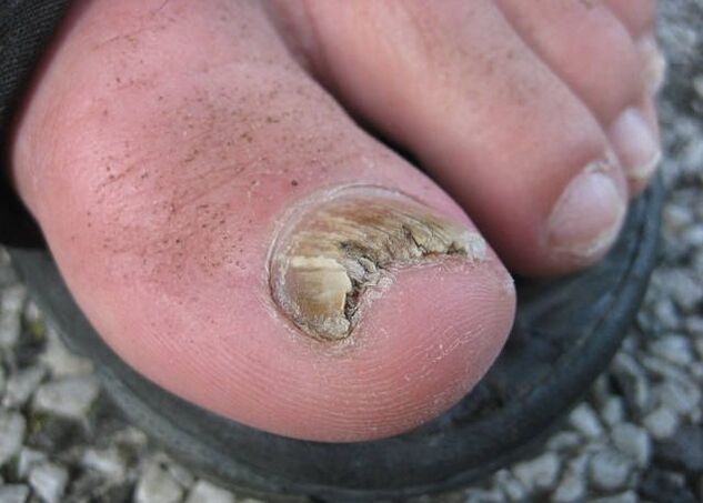 Rezultat zanemarjanja