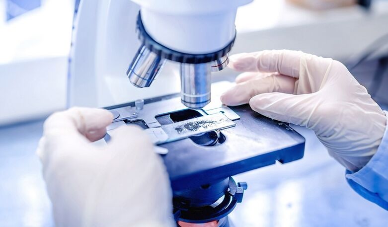 laboratorijska diagnoza glivic na nohtih na nogah