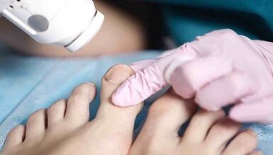 strojna obdelava gliv na nogah