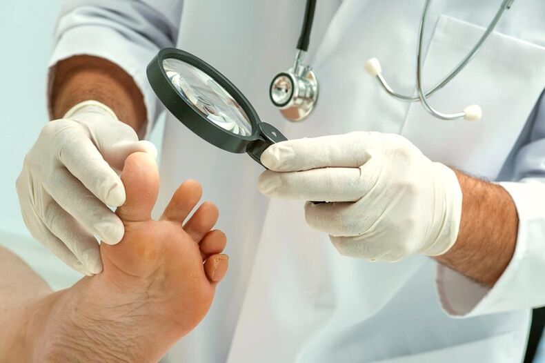 dermatolog pregleduje nohte na nogah