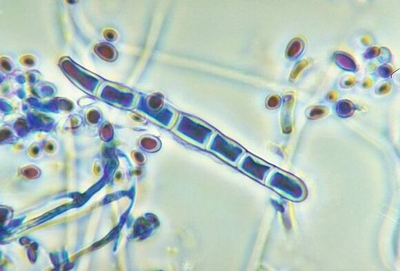 Gliva Trichophyton rubrum pod mikroskopom