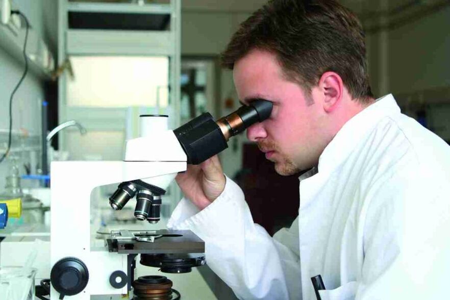 laboratorijska diagnoza glivic na nohtih